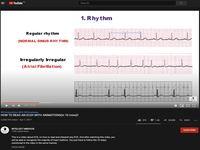 How to Read an ECG with Animations(in 10 Mins)!!