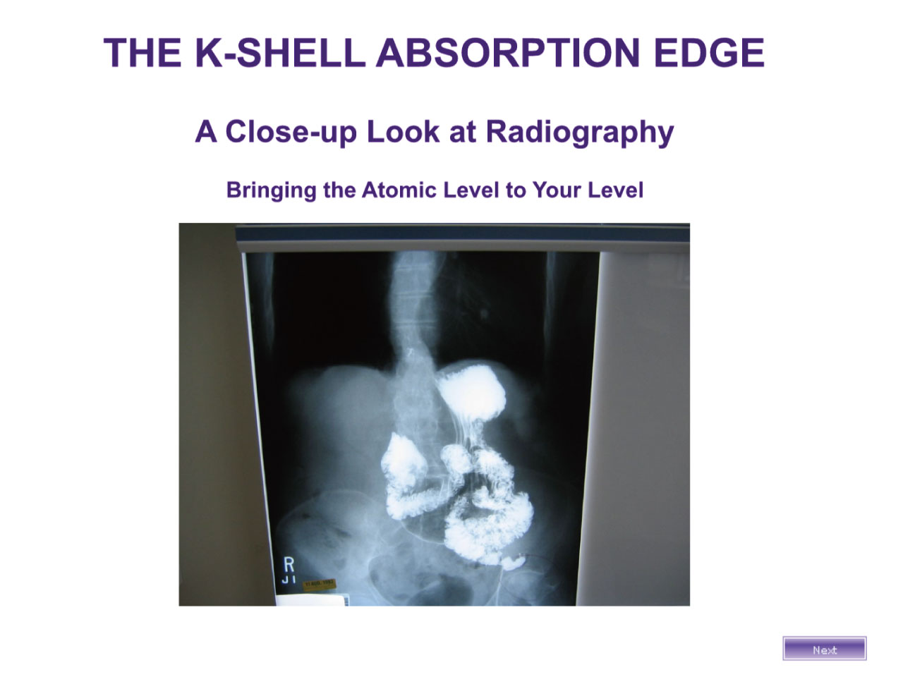 The K-Shell Absorption Edge: A Close-Up Look at Radiography