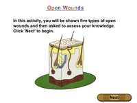 Open Wounds