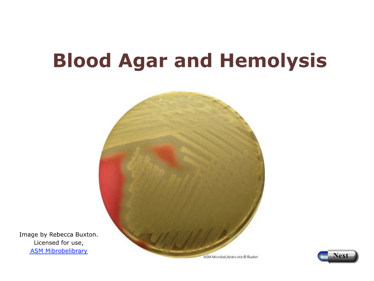 Blood Agar and Hemolysis