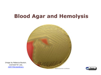 Blood Agar and Hemolysis